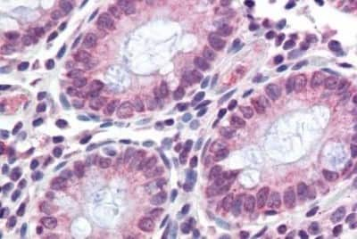 Immunohistochemistry-Paraffin: TMPRSS4 Antibody [NBP3-14501] - Immunohistochemistry of formalin-fixed, paraffin-embedded human colon after heat-induced antigen retrieval.